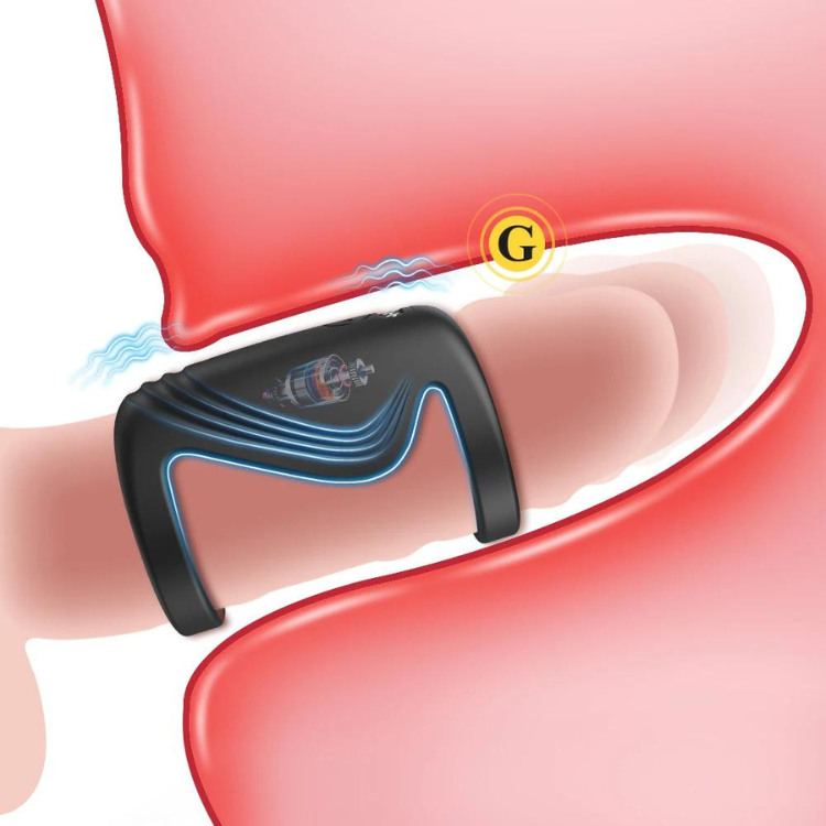 Illustration of a black vibrating penis ring worn at the base of a penis, with a G-spot marker